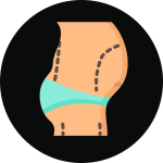 Full Abdominoplasty,full abdominoplasty with liposuction,full abdominoplasty cost,full abdominoplasty scar,abdominoplasty full vs mini