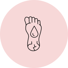 Cracked heel care,cracked foot care,Cracked heel care in Turkey