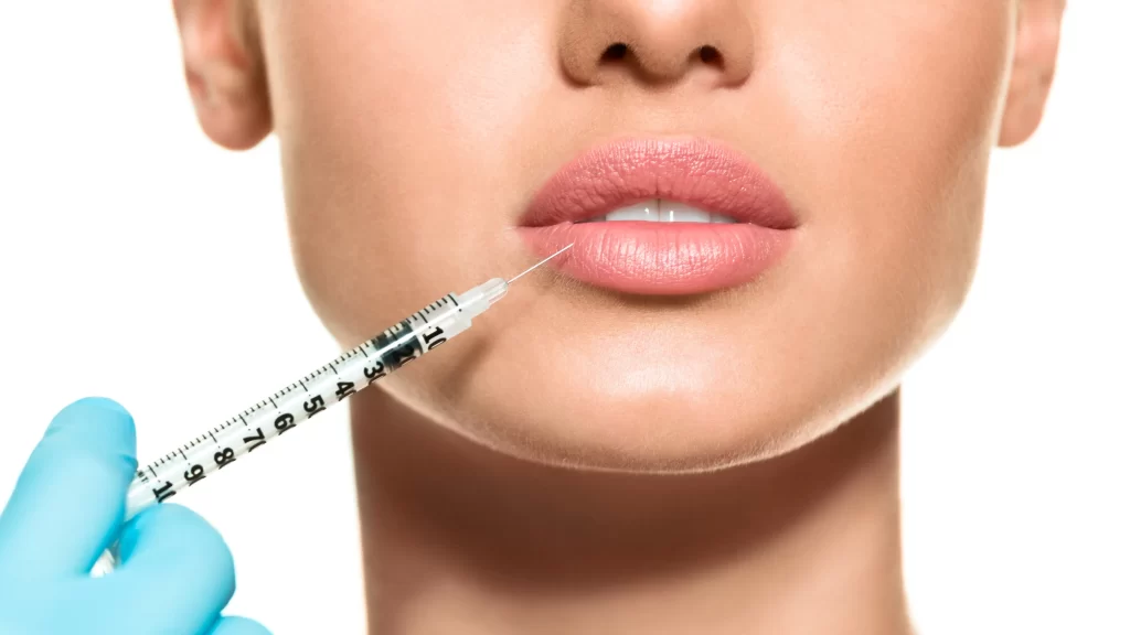 Lip filling,lip filling near me,lip filling cost,lip filling before and after,lip filling price