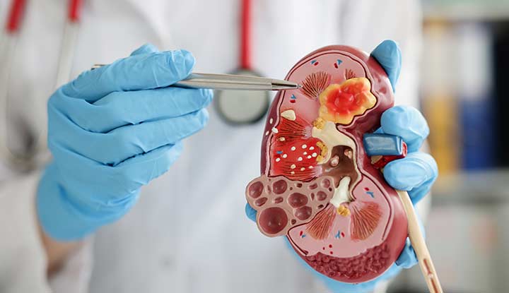 Nephrology,nephrology meaning,nephrology history taking
