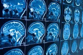 Radiology,radiology assistant,radiology masterclass
