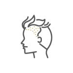 Hair Transplant,hair transplant istanbul,hair transplant turkey,hair transplant turkey cost,hair transplant antalya