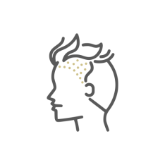 Hair Transplant,hair transplant istanbul,hair transplant turkey,hair transplant turkey cost,hair transplant antalya