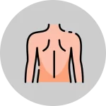 Waist Back Liposuction,Waist Back Liposuction in Turkey